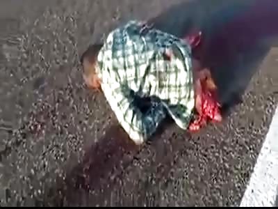 MAN RIPPED IN HALF IN MOTORBIKE CRASH