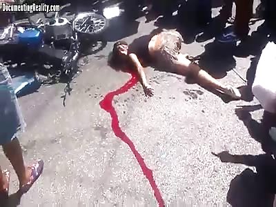 GIRL DYING AFTER MOTORCYCLE ACCIDENT