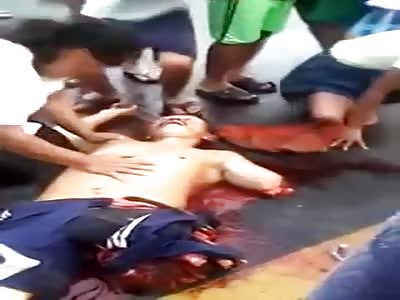 ARM AND LEG SEVERED IN MOTORCYCLE ACCIDENT