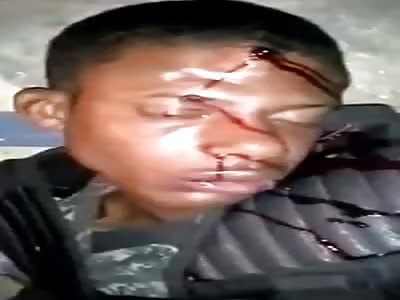 MAN DYING AFTER BEING SHOT IN THE HEAD