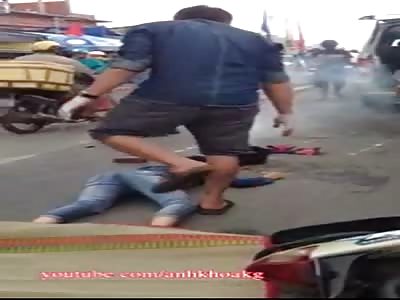 GIRL WITHOUT BRAIN AFTER AN ACCIDENT