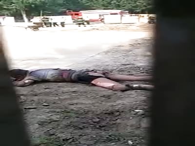 BURNED MAN WAITS FOR MORE THAN ONE HOUR FOR HELP