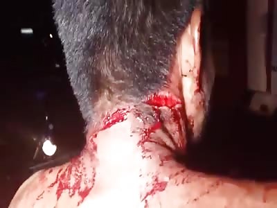 MAN SLASHED BY HIS WIFE IN MACHETE ATTACK