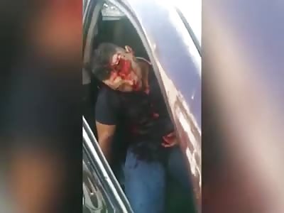 HEAD DESTROYED BY SHOT