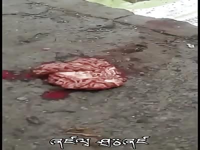 THE MAN WHO LOST HIS BRAIN