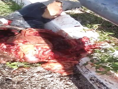 GORE EXTREME: AFTERMATH OF VIOLENT MOTORCYCLE ACCIDENT