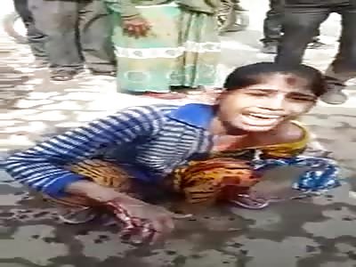 PAIN AND DESPAIR AS WOMAN LOSES HER ARM