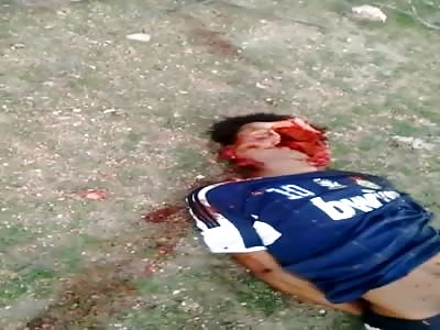 DEAD MAN HAS DEFORMED FACE AFTER CRIME