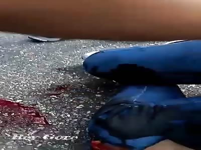 ACCIDENT: ONDE DEAD AND ONE BURST KNEE