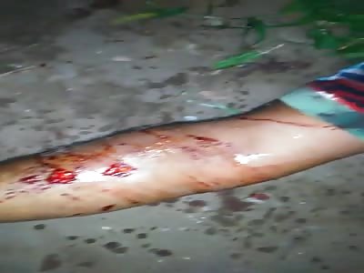 MURDERED MAN LYING ON THE GROUND