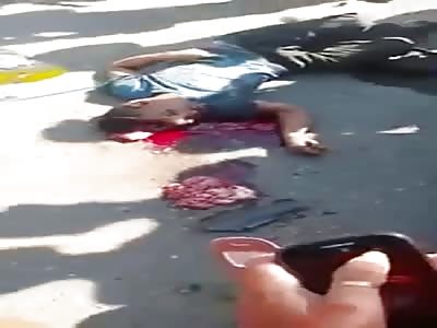 GORE DAILY DOSE: CRUSHED HEAD AFTER AN ACCIDENT