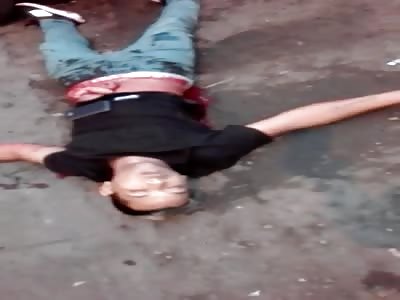 MAN LYING ON THE GROUND, EXPOSED GUTS