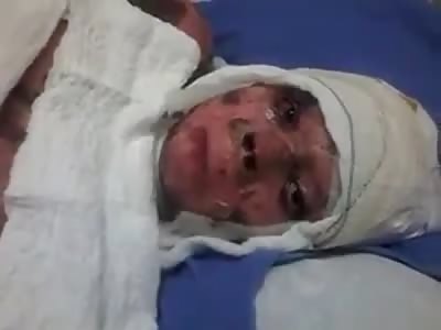 POOR LADY, BURNED BY HER EX-HUSBAND