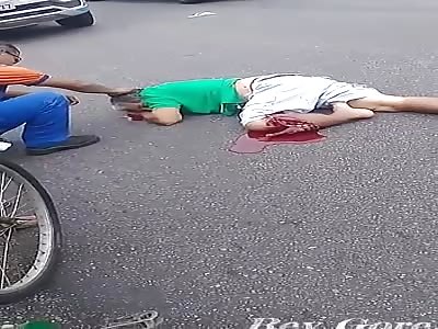 MAN LEG DESTROYED IN ACCIDENT