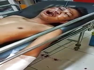 DESFIGURED FACE AND TOTAL AGONY