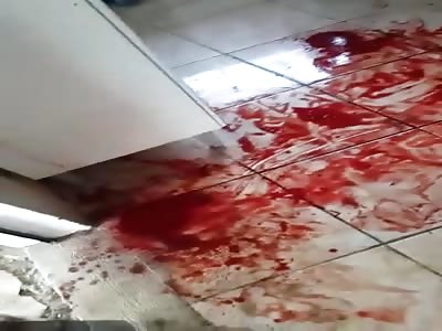 JUST A SCRATCH IN HIS HAND