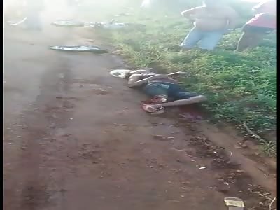 MAN LOSES LEG IN AN ACCIDENT