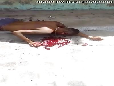 MAN DYING ON THE STREET