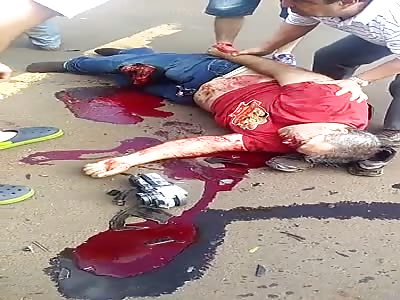 MAN IN BAD SHAPE AFTER MOTORCYCLE ACCIDENT