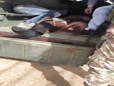 SEVERED LEG IN LANDMINE EXPLOSION