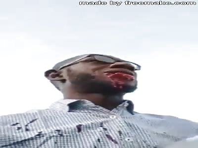 MAN HAD LIP TORN