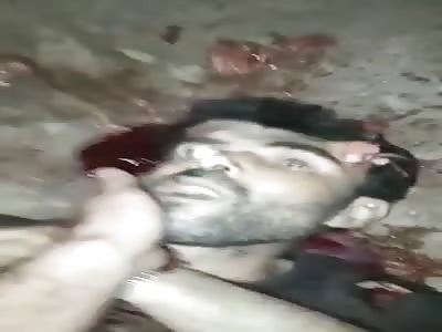 BLOODY SHOOTING AFTERMATH