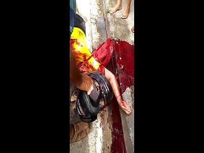 BLOODY MOTORCYCLE ACCIDENT