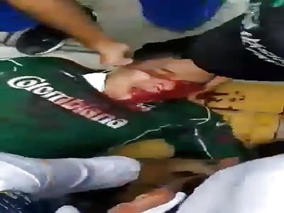 INJURED AND DEAD IN COLOMBIAN RIOT