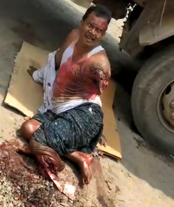 Still Alive and Hating Every Second