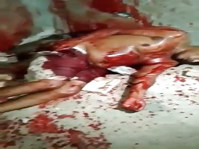 MAN DYING AFTER BEING SHOT