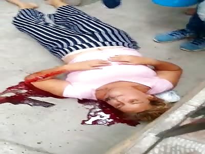 WOMEN WERE SHOT IN THE STREET