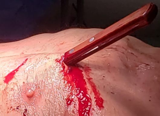 MAN STABBED HIMSELF IN THE CHEST