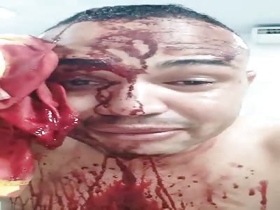 CRYING BABY WAS HIT WITH A BOTTLE