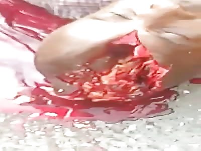 MAN'S SKULL OPENED IN THE STREET