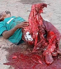 THAT SAD MOMENT YOU REALIZE YOU'RE FUCKED UP