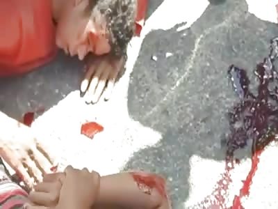 ACCIDENT LEAVES PEOPLE INJURED