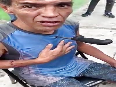 MAN WITH KNIFE STUCK IN THE CHEST 