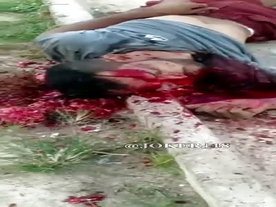 MAN'S HEAD TOTALLY FUCKED UP