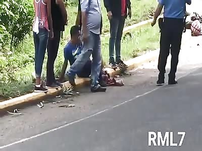 MAN'S SHATTERED LEG AFTER AN ACCIDENT (video doesn't work)
