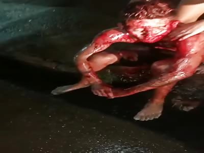 YOUNG MAN DYING AFTER HAVE BEEN STABBED