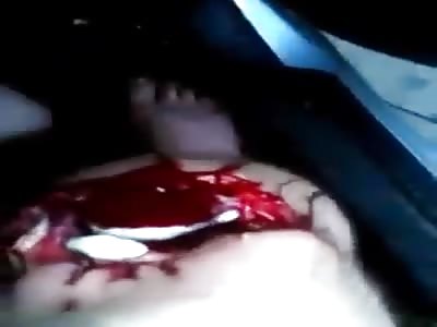 OUCH!!! OPEN KNEE IS NOT A GOOD THING!