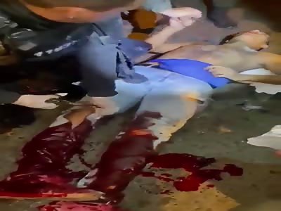 MAN WITH SHATTERED LEG HELPED ON THE STREET