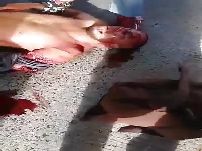 MAN WITH SHATTERED ARM HELPED ON THE STREET