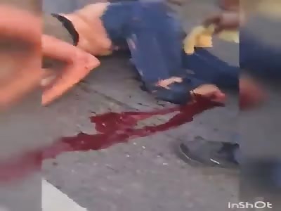 WHEN THE BODY FORGET THE LEG