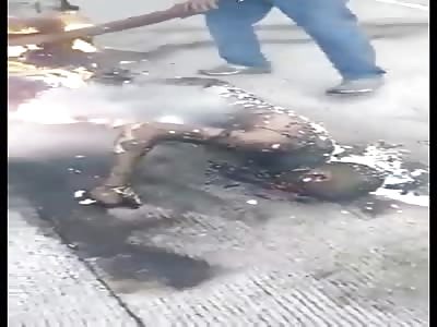 BIKER BURNED TO THE BONE AFTER AN ACCIDENT 