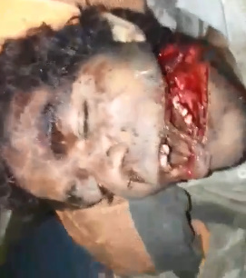 OMG!!! MAN HAD HIS HEAD SHREDDED AND IS STILL ALIVE