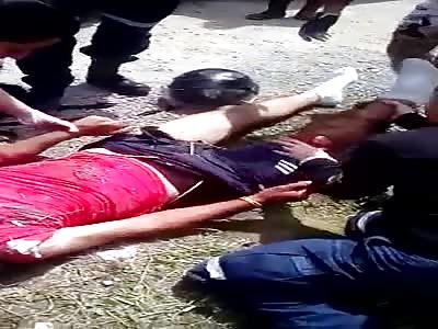 PAINFUL MOTORCYCLE ACCIDENT AFTERMATH 