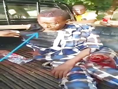 NIGERIAN TERRORIST CAPTURED WITH FRACTURED LEG