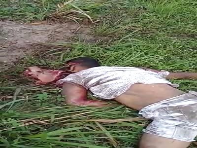 FUCK!!! HE LOST THE FACE IN A MOTORCYCLE ACCIDENT 