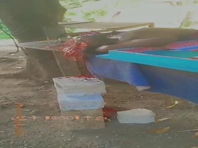 MAN WITH CRUSHED HEAD 